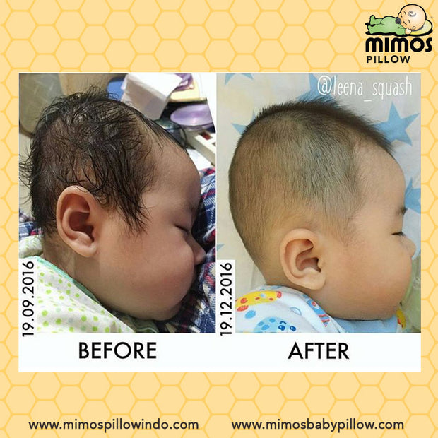 Mimos Pillow S (Newborn-6m / Head Circumference 36-46cm)